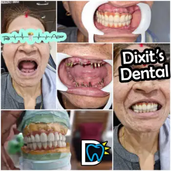 Patient treatment result