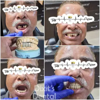 Patient treatment result