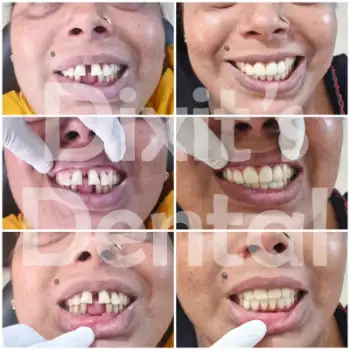 Patient treatment result