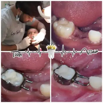 Patient treatment result