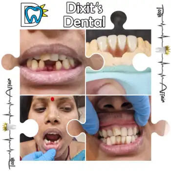 Patient treatment result