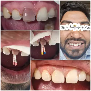 Patient treatment result