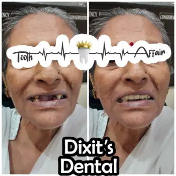 Patient treatment result