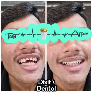 Patient treatment result