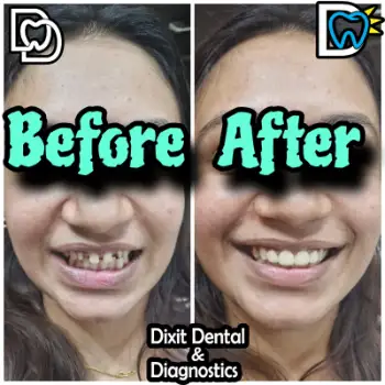 Patient treatment result