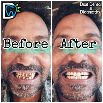 Patient treatment result