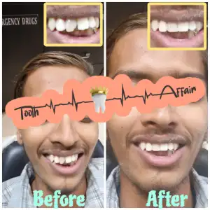 Patient treatment result